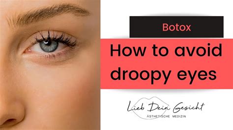 can botox help droopy eyelids